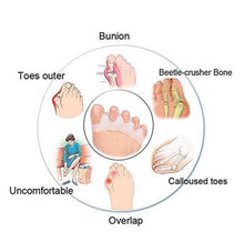 Load image into Gallery viewer, Silicone Hammer Toe Corrector
