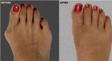 Load image into Gallery viewer, Silicone Hammer Toe Corrector
